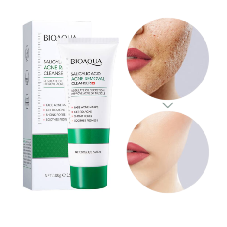 Miniatura 3 de JABON ACIDO SALICILICO BIOAQUA 100g